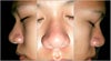 Left, front, and right view. It has bumps, black heads, big pores and oily too. how to get rid these problems? what's wrong about my nose?