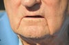 Jack's mouth lines
