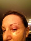 You can see the left eye, one can see the line above the cheek.