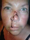 it is from my nose down that is the problem