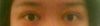 Left eye smaller than right eye