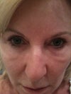 What are these bags under my eyes?