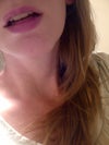 These are my lips before juvi