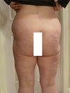 Rear side. Not happy with the outcome of saddle bag removal. The lack of knee symmetry he said he will address. I have not voiced my extreme displeasure with the depressions on the saddle bags yet. I would like some feedback so I know how to approach this. Anything you can offer is very appreciated.