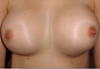 4 weeks post