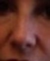 This is my nose before the nose job. This is a front view. I had a bump removed & the bridge thinned a little and the tip.