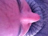 From above -showing lump on tip