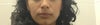 Front view. My skin isn't tight and youthful. Right side looks saggy. Both cheeks look deflated