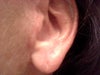 Left Earlobe
