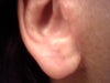 Right Earlobe