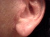 Left Earlobe