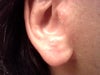 Right Earlobe
