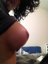 Side view of right breast