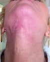 taken 11/30, my neck has some lumpy areas, will these go away?