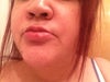 my lip
