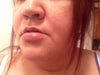 also my lip