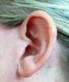 Left Ear