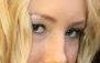 Right eye
