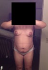 Front big belly - 2 c-sections - My breasts are uneven due to Breast-feeding