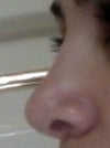 Before