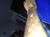 Left arm
1 and 2nd degree burn?