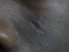 My face 2