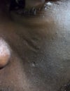 My face 3