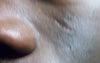 My face 4