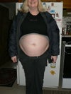 here is a pict day before my surgery on march 21st 2012