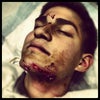 Day of the accident.