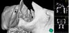 right infraorbital canal...looks very strange . there is 3 holes now..i wonder through which one the infraorbital is going/pass