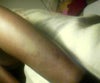 scar 3