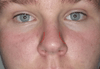 With the markings. I would like it to be slightly narrowed like this. I want to leave the tip of my nose alone in width, and just have the bridge ease into the tip and nostrils like so. I don't my nose looking pinched or anything.