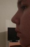 Side view. It feels like my nose is slightly upturned, because my nostrils show more than normal in front view. In front view my nostrils kind of hang below my nose instead of with it. If you look at angelina jolie's nose, her profile