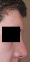 Before pressing. This is how it looks 90% of the time. I know pressing can delay the results, that was answered in my previous question. I've stopped doing it AS OFTEN, but I can't help but do it sometimes. I'm working on it.