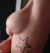 Rt Breast
