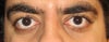 Without glasses