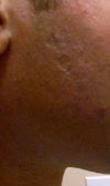 right side of face