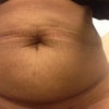 After: 2 weeks