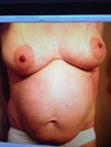 pre-op