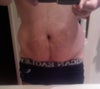 32-year-old male, 6'4, 215 lbs, from L.A. I lost about 100 lbs years ago and have been contemplating getting my stomach and love handles done