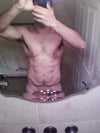 male tummy tuck impact on abs?