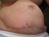 my abs are very asymmetrical and lumpy