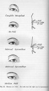 Anatomy of Asian Eyelids