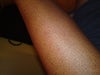 black dots all over my body