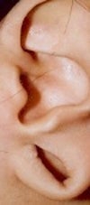 Gauge earlobe cost