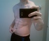 full or mini abdominoplasty?