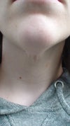 under chin skin