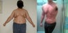 massive weight loss