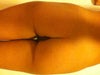 Buttocks before fat injection
